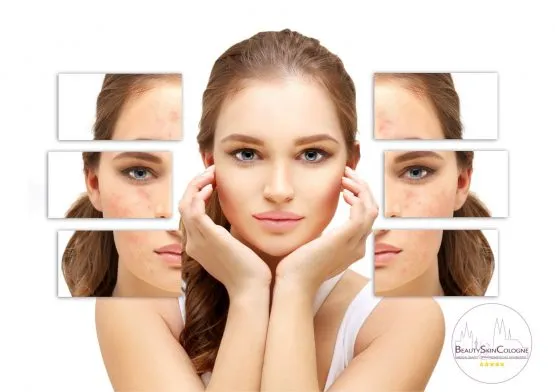 Vorher-Nachher Vergleich Hautbehandlung Beauty Skin Cologne