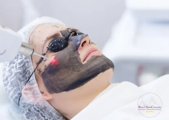 Carbon Peeling Gesichtsbehandlung im Beauty Skin Cologne