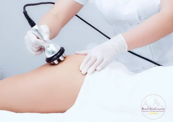Radiofrequenztherapie bei Beauty Skin Cologne